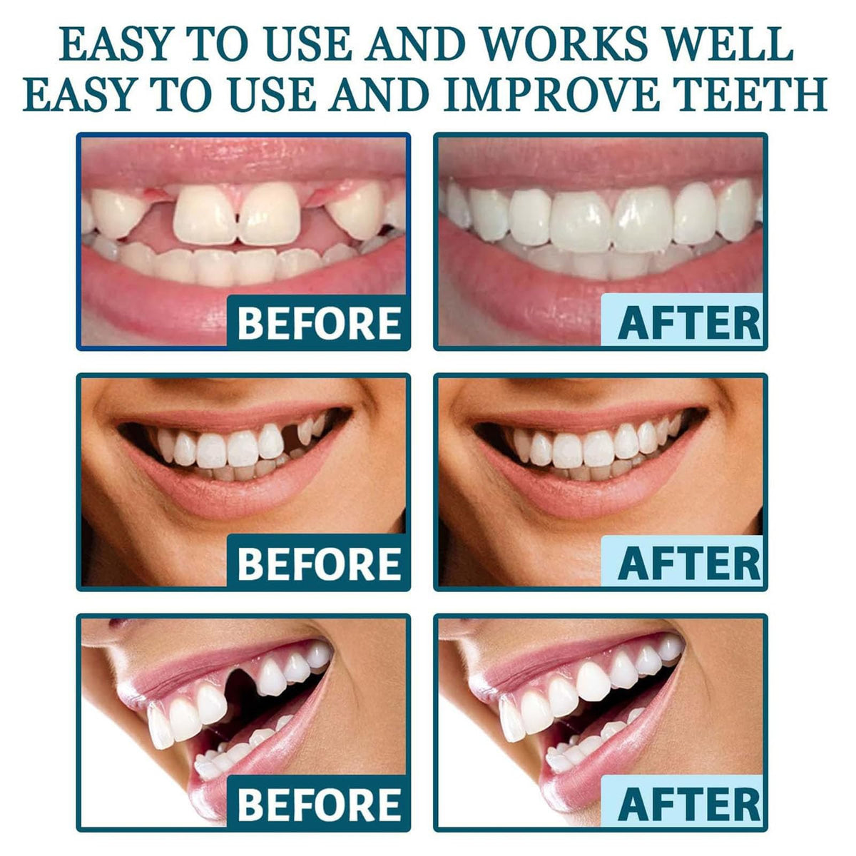 Clip on Veneers Silicone Kit for Both Upper and Lower (3Set) V746